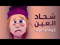 شحاد العين الأسباب وأفضل العلاجات للتخلص منه Stye Sty 