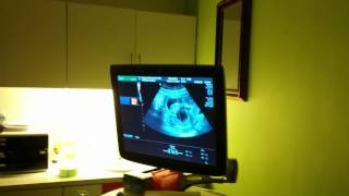 VID 20140524 110741