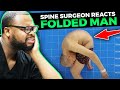 Spine Surgeon Reacts to the "Folded Man"
