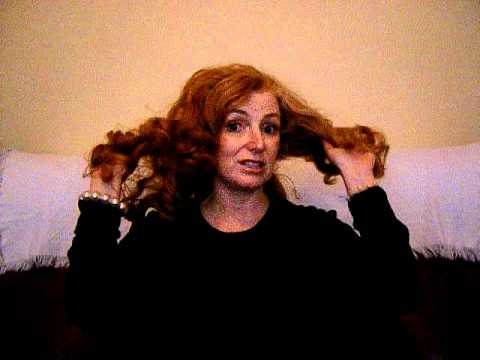 Mary Corrigan on Alopecia Areata & Diffuse Hair Loss 1