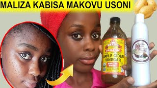 TIBA ya MADOA na MAKOVU USONI | SCRUB na MAFUTA mazuri | DIY facial scrub