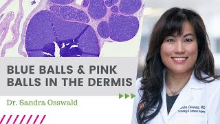 Blue Balls and Pink Balls in the Dermis / July 2020 \ Dermpath Happy Hour