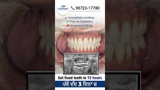 15,000+ Dental Implants in Jalandhar | Fixed Teeth in Just 3 Days!  #indiandentists #dentalhospital