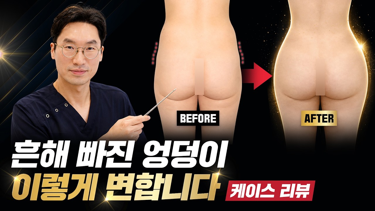 뽐나게빼의원 유튜브 영상