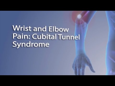 Cubital Tunnel Syndrome | FAQ with Dr. Sophia Strike