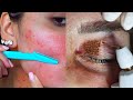 Most Extreme Beauty Treatments 2023 Best Smart and Helpful Beauty Hacks | Virtual Beauty