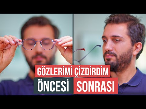 LAZER GÖZ AMELİYATI OLDUM -  Öncesi, Sonrası ve Tüm Yaşadıklarım