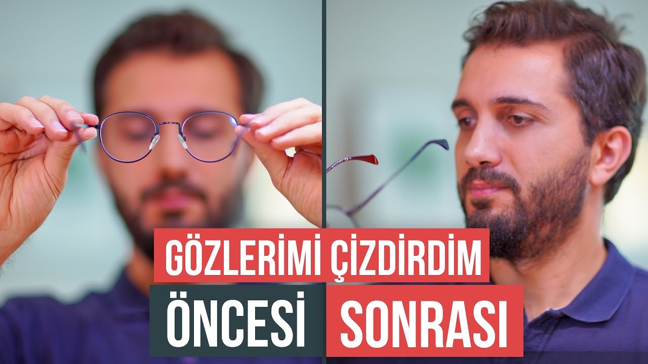 Lazer Goz Ameliyati Oldum Oncesi Sonrasi Ve Tum Yasadiklarim Youtube