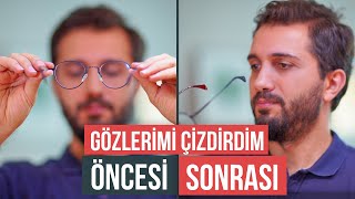 LAZER GÖZ AMELİYATI OLDUM - Öncesi, Sonrası ve Tüm Yaşadıklarım