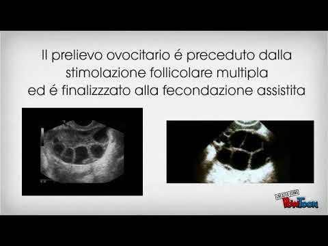 Video: Effetti Dei Modulatori Ciclici Dell'adenosina Monofosfato Sulla Maturazione E Sulla Qualità Degli Ovociti Di Topo Allo Stadio Germinale Riscaldati Con Vetrificazione