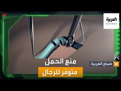 فيديو: هل يمكن عكس قطع القناة المنوية؟