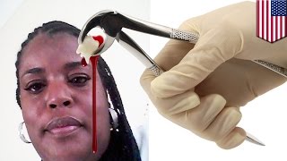 Dental disaster? Michigan woman dies after getting 16 teeth pulled at the dentist - TomoNews