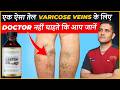 Castor Oil For Varicose Veins Temporary Relief Or Long Term Solution Dr Gaurav Gangwani