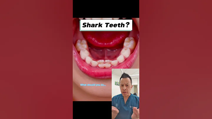 Dealing With Bottom Front Teeth Coming Out Crooked #shorts #dentalhealth #sharkteeth #dentist