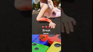 Amazing Healing Process Broken Arm