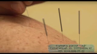 Иглоукалывание в Москве. Пульсовая диагностика Доктора ТАЙ. Иглоукалывание в Москве. Пульсовая диагностика Доктора ТАЙ.
