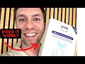 Smile Direct Club Teeth Whitening Review - Does It Work? (My Results)