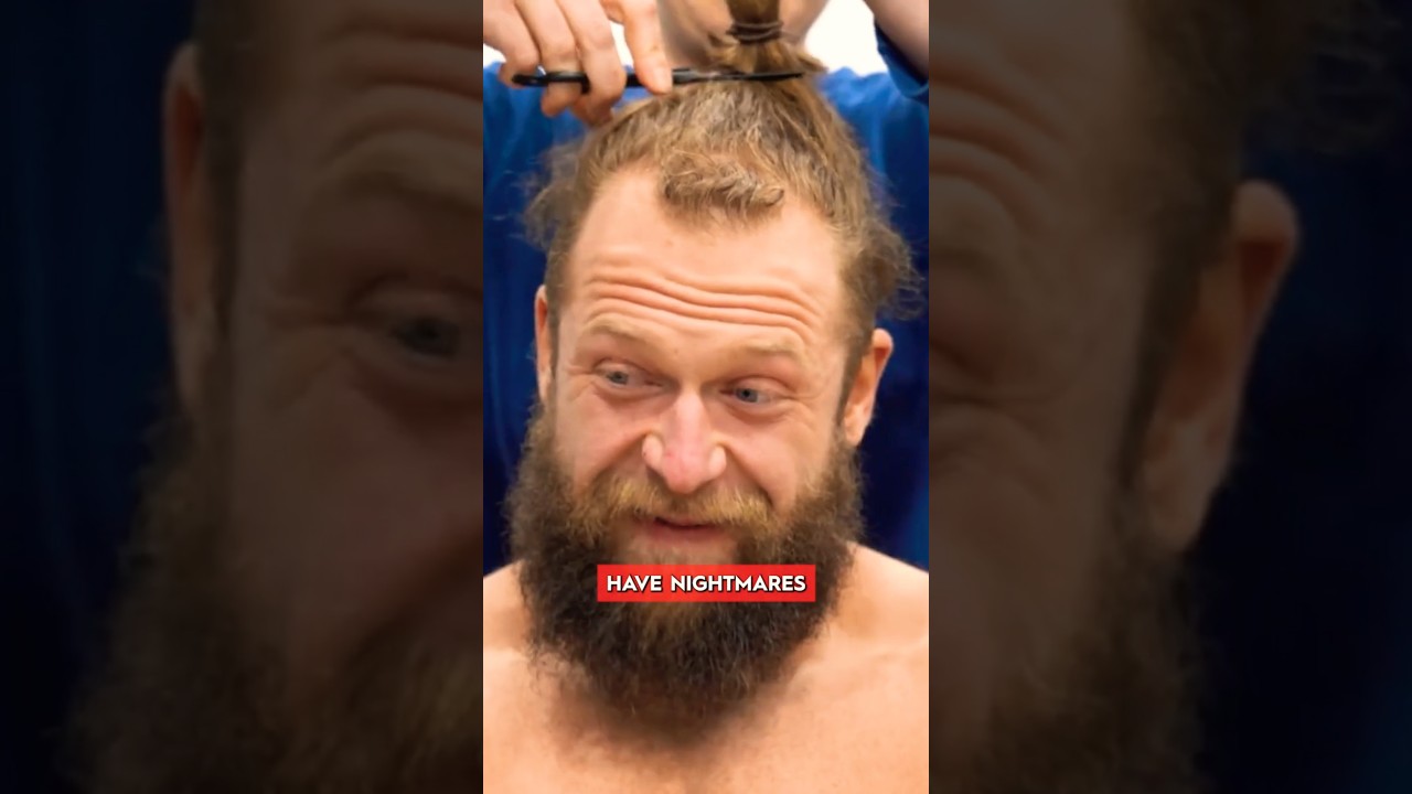 Long Hair To Hair Transplant 
