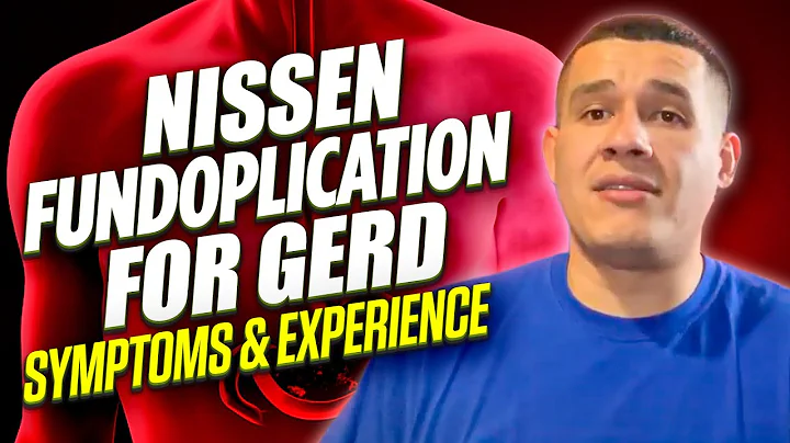Nissen Fundoplication for GERD (Symptoms & Experie...