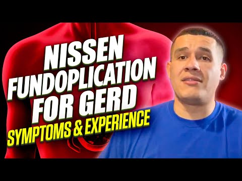 Nissen Fundoplication for GERD symptoms & experience