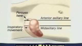 Examination of the Spleen