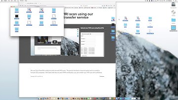 How to Transfer your MRI scan