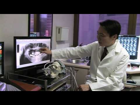 Gum Disease Treatment for Damaged Teeth. Dental Im...