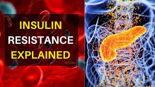 Insulin Resistance Explained | Why And How It Happens | Key Signs And Symptoms To Look Out For