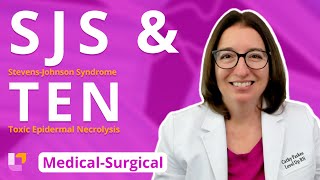 (SJS) Stevens-Johnson Syndrome & (TEN) Toxic Epidermal Necrolysis -Medical-Surgical | @LevelUpRN