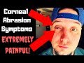 Corneal Abrasion Symptoms & Treatment ( My Ongoing Painful Situation!)