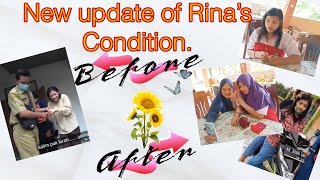 Rina's New Update | Rina's Recovery | Rina Indonesian Girl