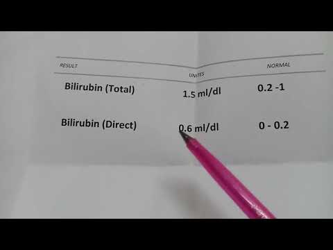 فيديو: كيفية خفض مستوى البيليروبين: 12 خطوة (بالصور)