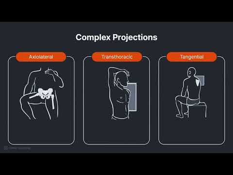 Radiographic Projections - video from Clover Learning