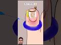 ASMR animation Foot piercing removal treatment #asmr #animation #shortsvideo #trending