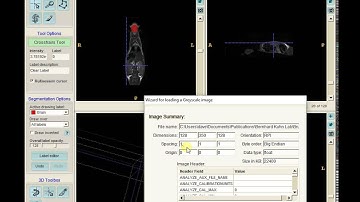 Mouse Organ Segmentation with ITK Snap Part 3