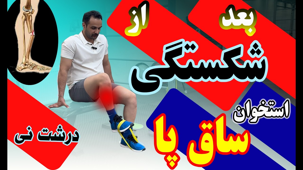 شکستگی استخوان درشت نی ساقپلاتوی تیبیا