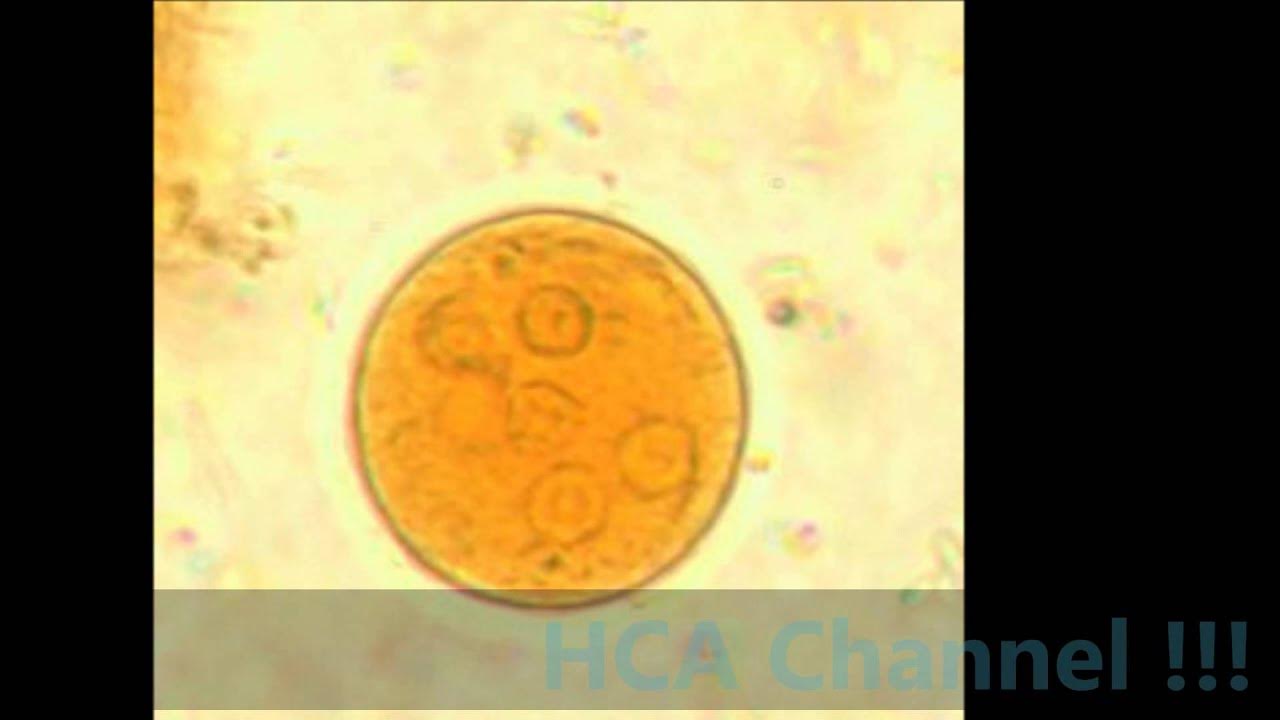 Цисты entamoeba. Вегетативная форма entamoeba coli. Entamoeba coli в кале что это. Цисты лямблии микроскопия. Entamoeba gingivalis микроскопия.