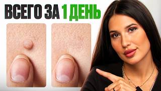 видео: Я нашла НОВОЕ СРЕДСТВО! Как НАВСЕГДА избавиться от папиллом картинка: Я нашла НОВОЕ СРЕДСТВО! Как НАВСЕГДА избавиться от папиллом