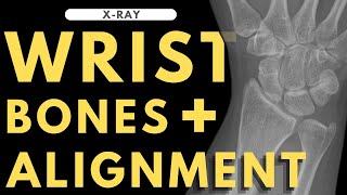 Wrist bones and alignment | Radiology anatomy part 1 prep | Wrist X-ray interpretation