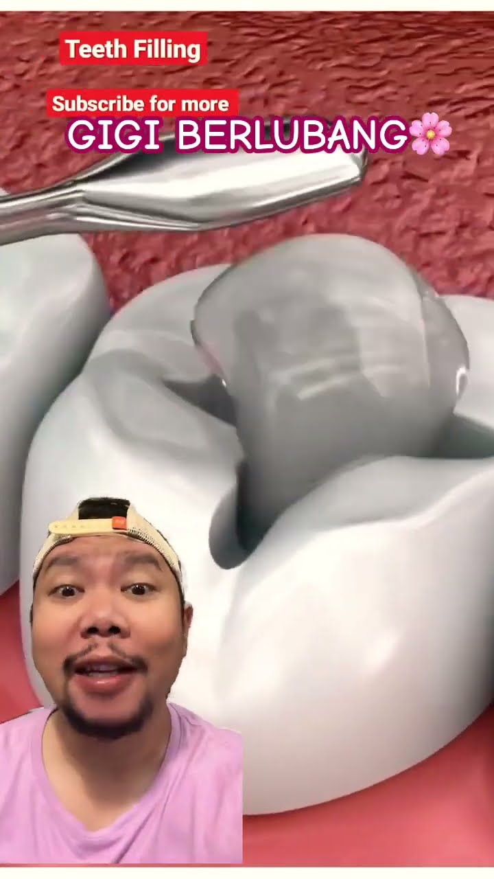 PERGI KE DOKTER GIGI!!!?? #dentist #teeths #teethwhitening #short #shorts
