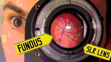 The Optics and Image Processing Behind Fundus Cameras