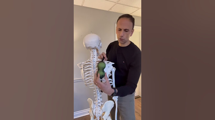 How to Treat Muscle Knots Under Your Shoulder Blade 💪🏽 #shorts #shoulderpain