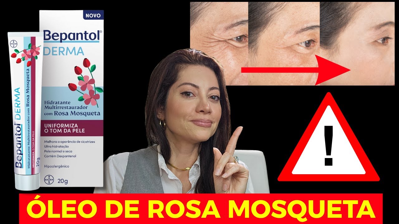 O Que NINGUÉM Te Conta Sobre o ÓLEO de ROSA MOSQUETA | Dra. Greice Moraes