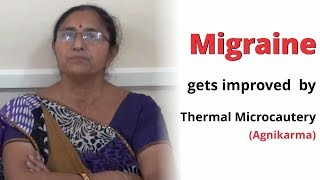 Ayurveda Treatment for Migraine | Migraine gets improved by Agnikarma (Thermal Microcautery)