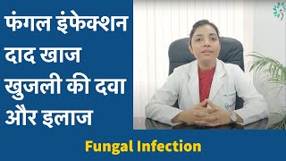 फंगल इंफेक्शन (Fungal Infection) दाद खाज खुजली की दवा और इलाज #daadkhajkhujli