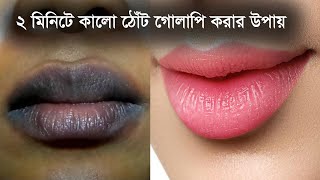 ঠোঁটের কালো দাগ দূর করে গোলাপি করার সহজ উপায় | কালো ঠোঁট গোলাপি করার সহজ উপায় | Pink Lips screenshot 3