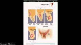Miniatlas Pediatrics App screenshot 5