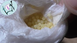 Tarantula Egg Sac Opening Orphnaecus Sp. Quezon Blue Tarantula Breeders Diary