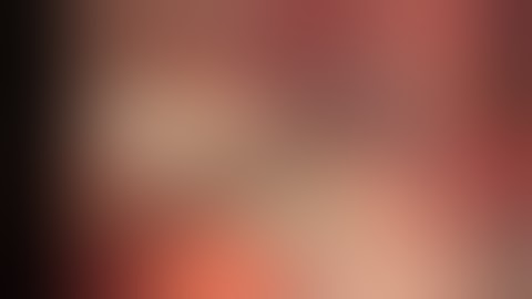 Sylvian Fissure Dissection