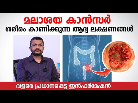 മലാശയ കാൻസർ ശരീരം കാണിക്കുന്ന ആദ്യ ലക്ഷണങ്ങൾ | Colorectal cancer Malayalam | Dr Shabeer Ali T U